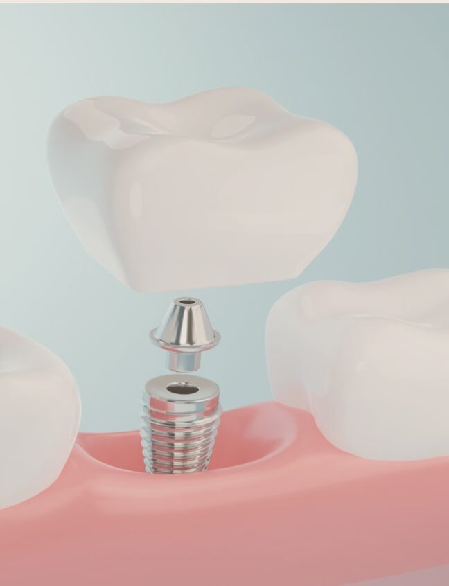 Treatment - Shirland Dental
