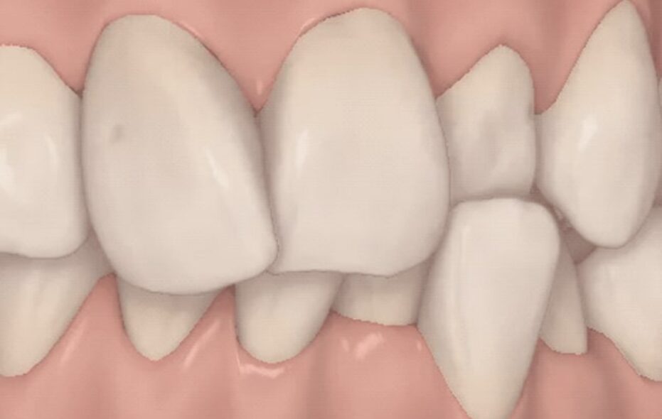 blog - Shirland Dental