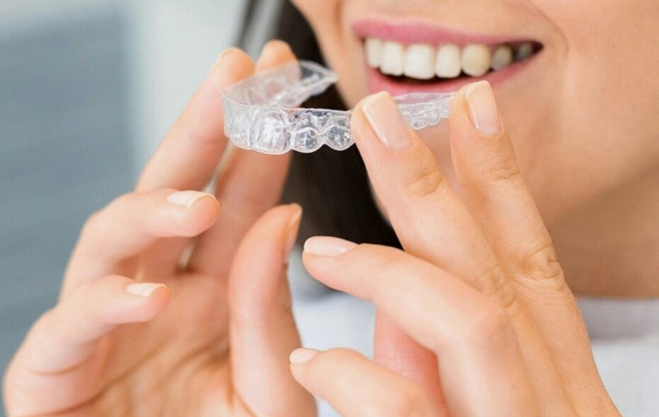 Best Invisalign Dentist London: Transform Your Smile with Confidence